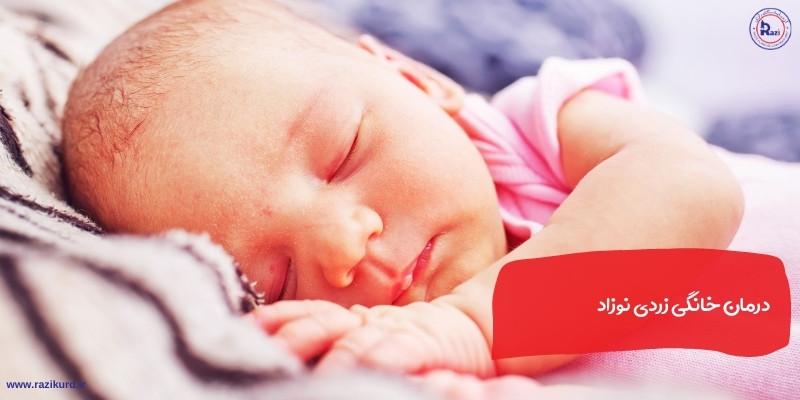 درمان خانگی زردی نوزاد