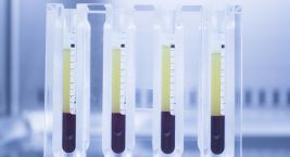 آزمایش نوع پلاکت ها | بیماری های خونی