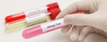 آزمایش های پاسخ آلرژیک | بیماری های خونی