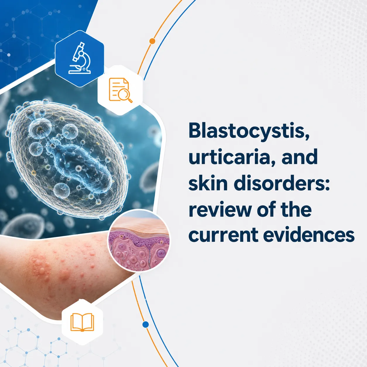 Blastocystis, urticaria, and skin disorders review of the current evidences