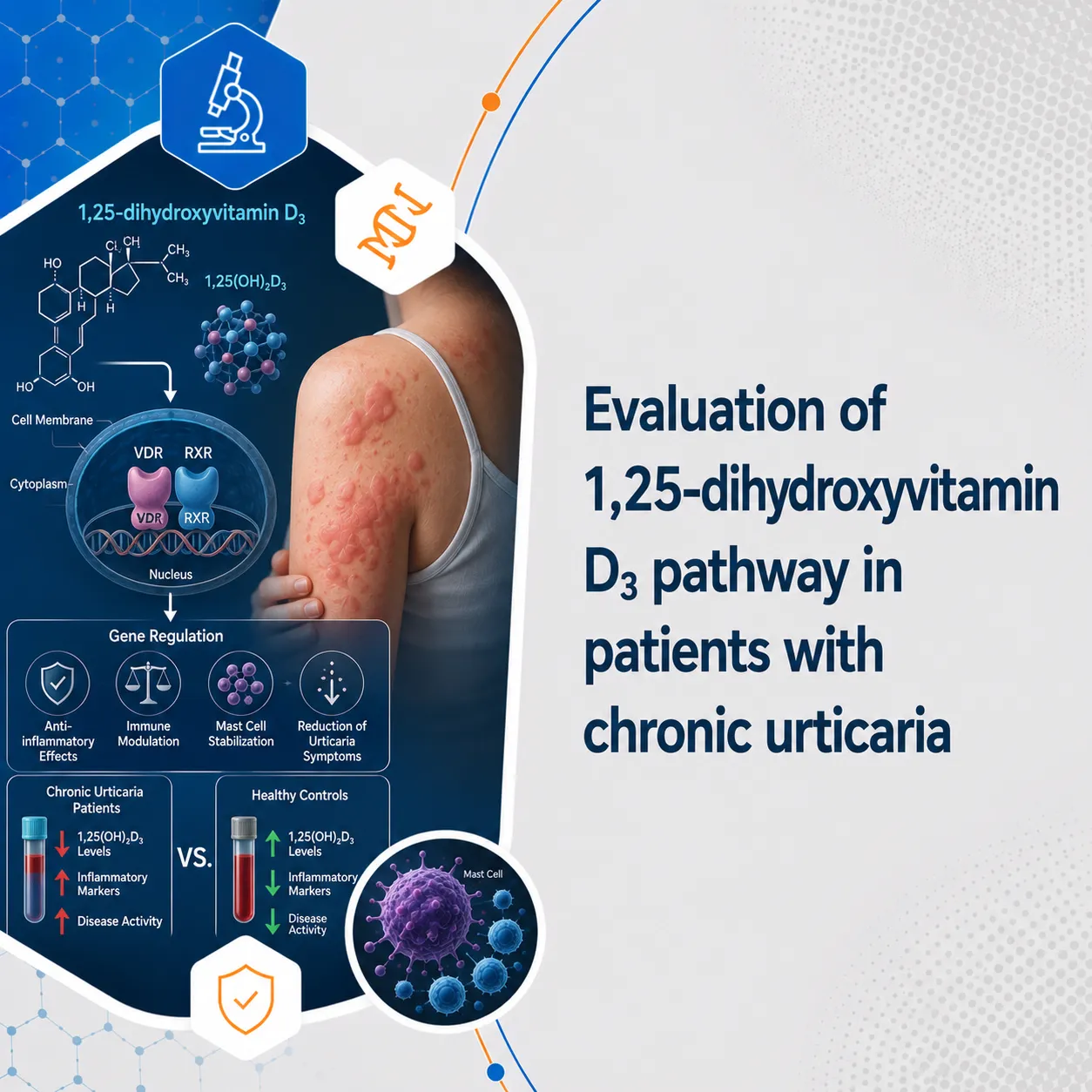 Evaluation of 1,25-dihydroxyvitamin D3 pathway in patients with chronic urticaria