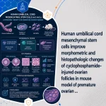 Human umbilical cord mesenchymal stem cells improve morphometric and histopathologic changes of cyclophosphamide-injured ovarian follicles in mouse model of premature ovarian ...
