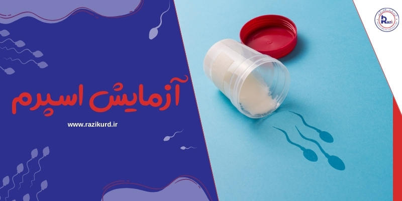 آزمایش اسپرم