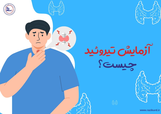 آزمایش تیروئید