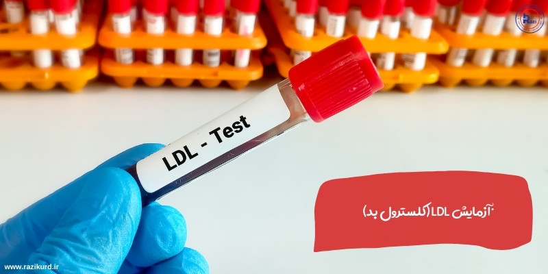 آزمایش LDL کلسترول بد