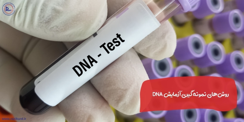 روش‌های نمونه گیری آزمایش ژنتیک