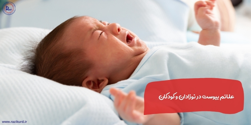 علائم یبوست در نوزادان و کودکان