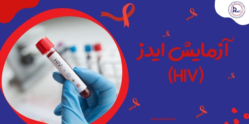 آزمایش ایدز