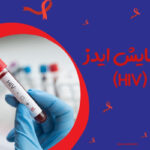 آزمایش ایدز (HIV)