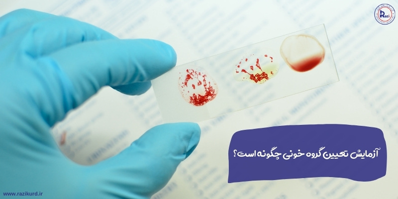 آزمایش تعیین گروه خونی چگونه است
