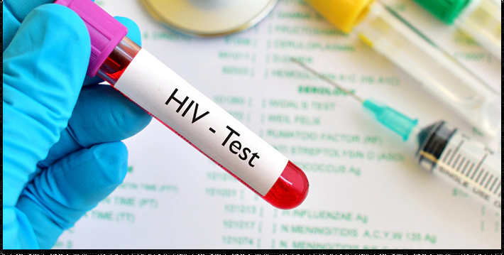 آزمایش HIV