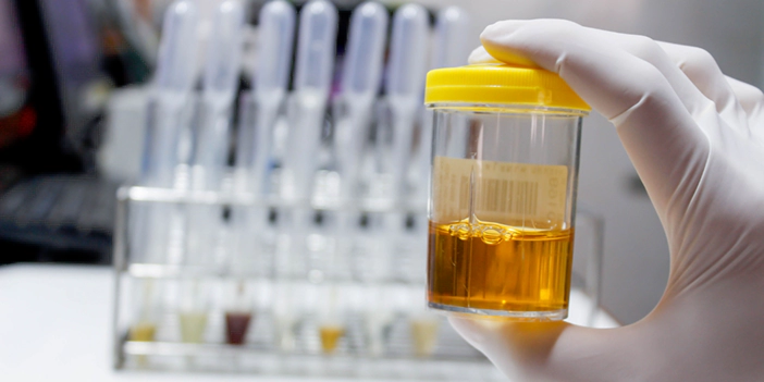 آزمایش ادرار و مدفوع