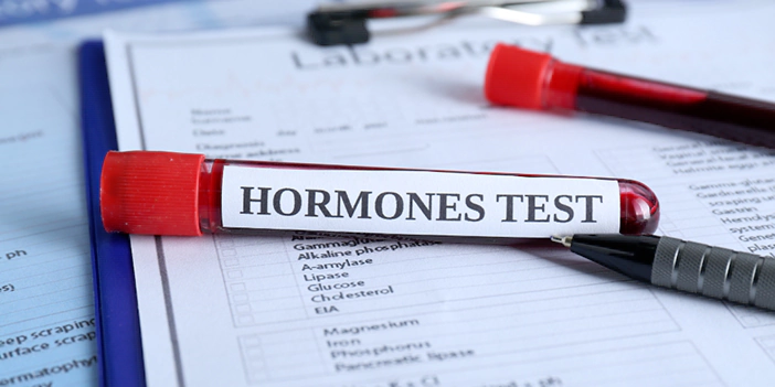 آزمایش هورمون