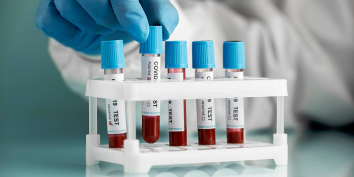 آزمایش ویروسی و بیماری‌های عفونی